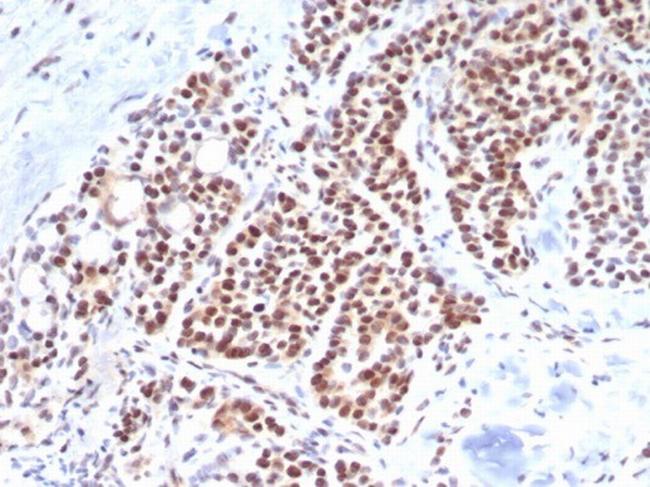 TBXT/T-box transcription factor T/Brachyury Antibody in Immunohistochemistry (Paraffin) (IHC (P))