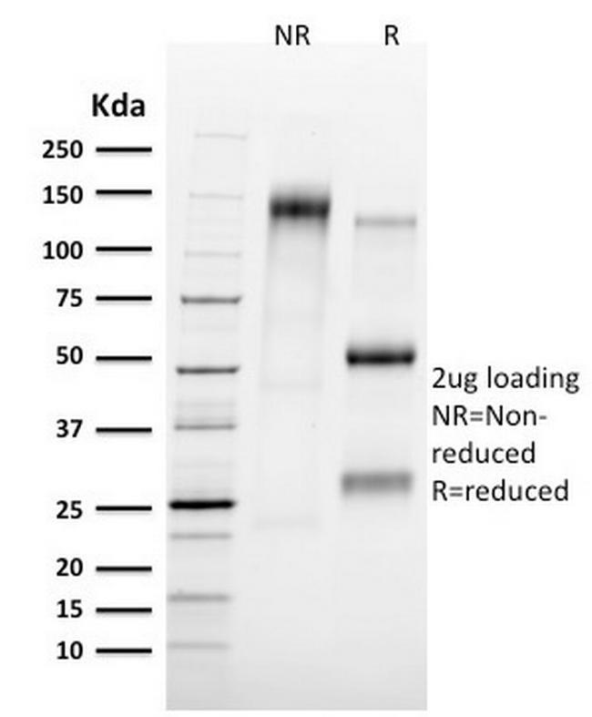 Tal1 Antibody in SDS-PAGE (SDS-PAGE)