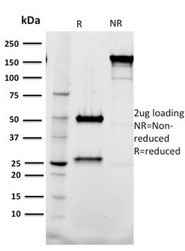 Tal1 Antibody in SDS-PAGE (SDS-PAGE)