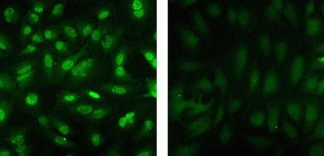 Phospho-JNK1/JNK2 (Thr183, Tyr185) Antibody in Immunocytochemistry (ICC/IF)