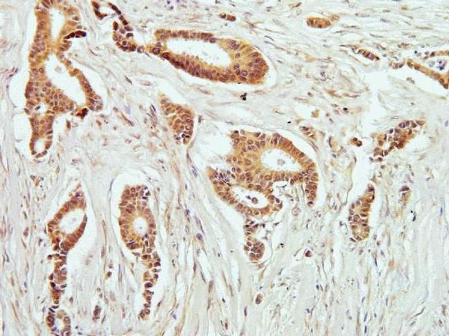 Phospho-PKC theta (Thr538) Antibody in Immunohistochemistry (Paraffin) (IHC (P))