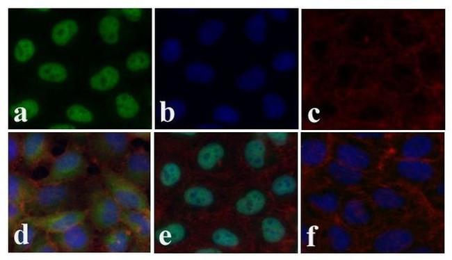 SMAD2 Antibody in Immunocytochemistry (ICC/IF)