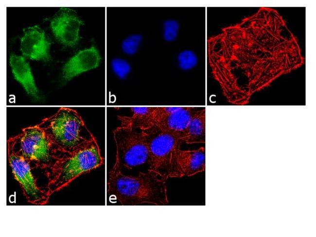 TAK1 Antibody in Immunocytochemistry (ICC/IF)