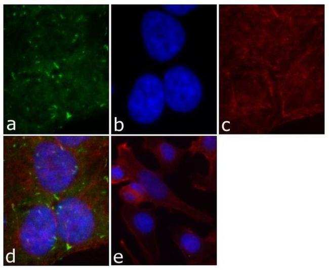 Phospho-FAK (Tyr861) Antibody in Immunocytochemistry (ICC/IF)