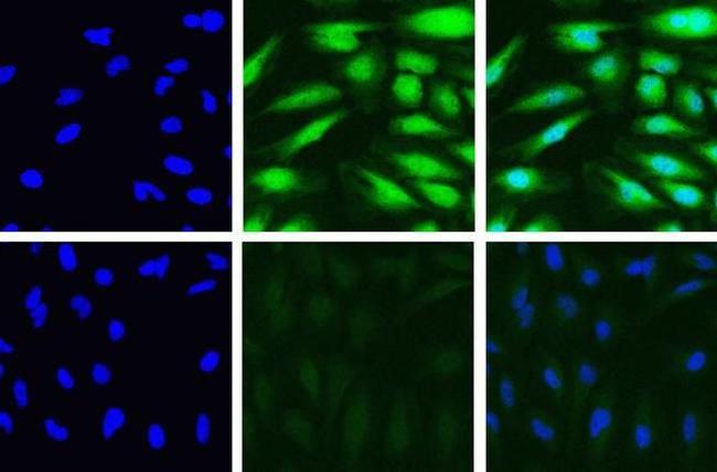 PSME3 Antibody in Immunocytochemistry (ICC/IF)