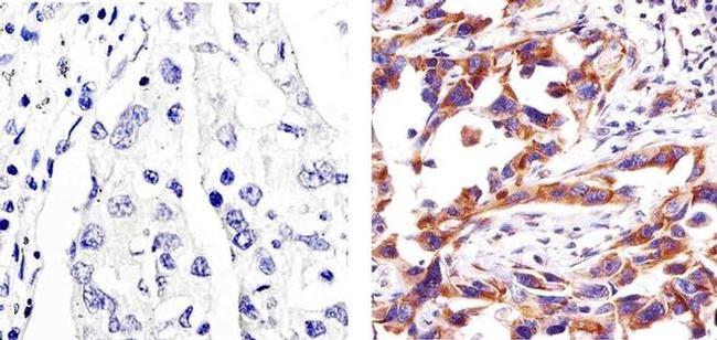 Caspase 3 Antibody in Immunohistochemistry (Paraffin) (IHC (P))