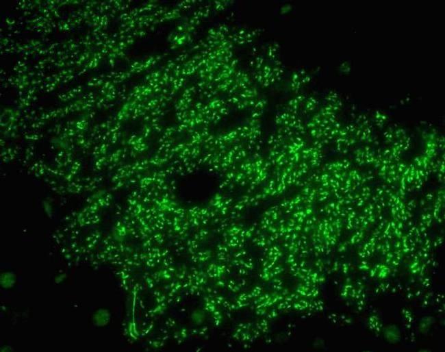 Afadin Antibody in Immunohistochemistry (Paraffin) (IHC (P))