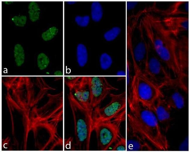 Phospho-4EBP1 (Thr37) Antibody in Immunocytochemistry (ICC/IF)