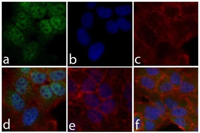 Phospho-STAT6 (Tyr641) Antibody in Immunocytochemistry (ICC/IF)