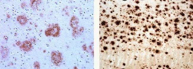 beta Amyloid Antibody in Immunohistochemistry (Paraffin) (IHC (P))