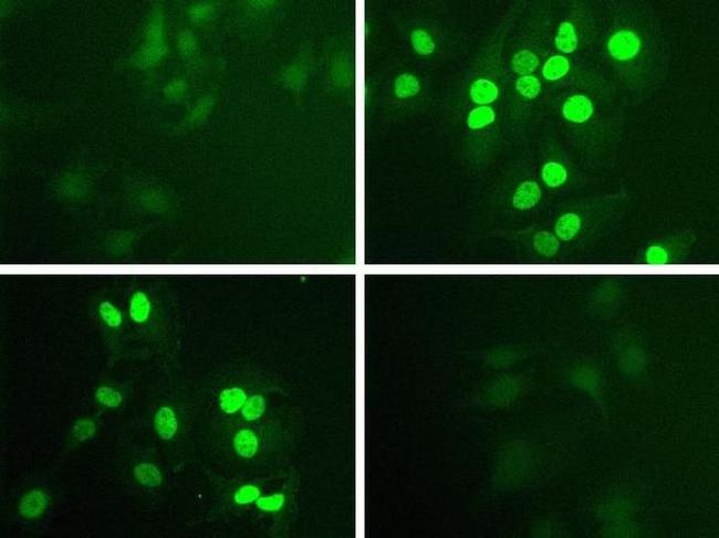 Phospho-STAT1 (Tyr701) Antibody in Immunocytochemistry (ICC/IF)