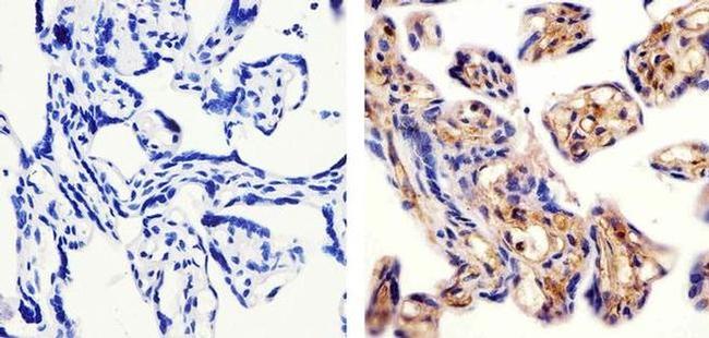 MDA5 Antibody in Immunohistochemistry (Paraffin) (IHC (P))