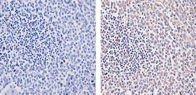 RIG-I Antibody in Immunohistochemistry (Paraffin) (IHC (P))