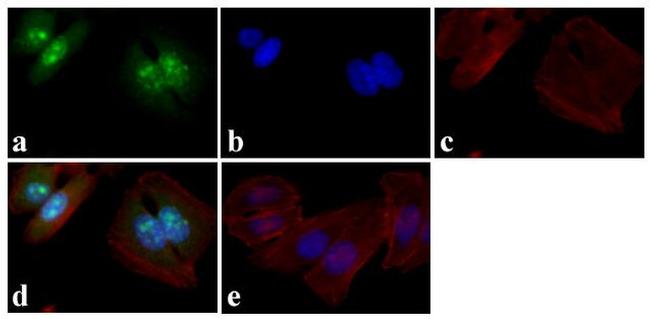 Phospho-p53 (Ser15) Antibody in Immunocytochemistry (ICC/IF)