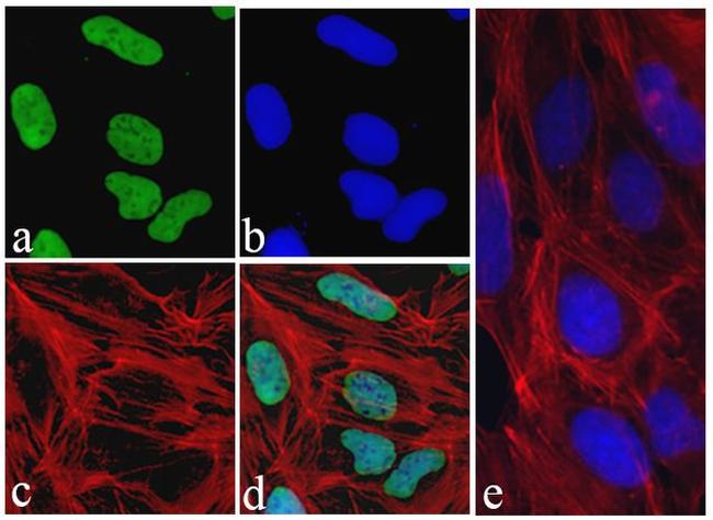 c-Myc Antibody in Immunocytochemistry (ICC/IF)