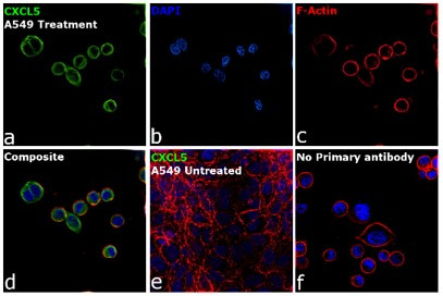 CXCL5 Antibody in Immunocytochemistry (ICC/IF)