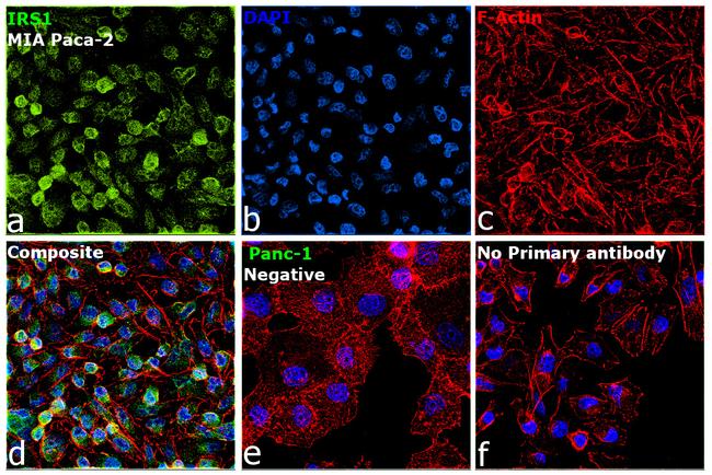 IRS1 Antibody in Immunocytochemistry (ICC/IF)