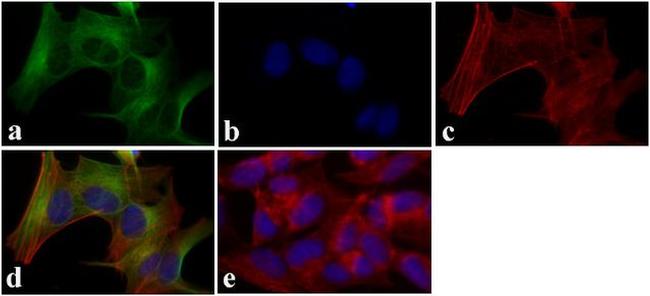 LC3B Antibody in Immunocytochemistry (ICC/IF)