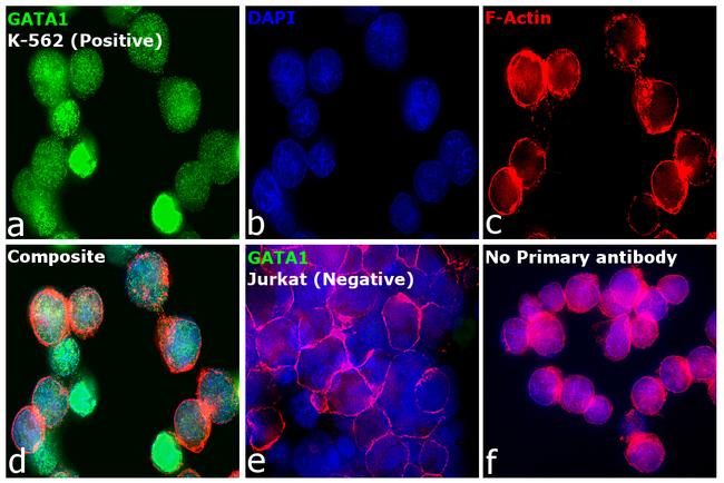 GATA1 Antibody in Immunocytochemistry (ICC/IF)