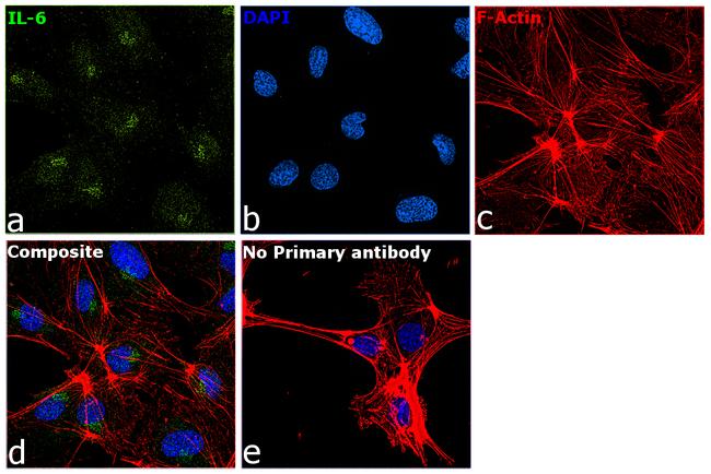 IL-6 Antibody in Immunocytochemistry (ICC/IF)