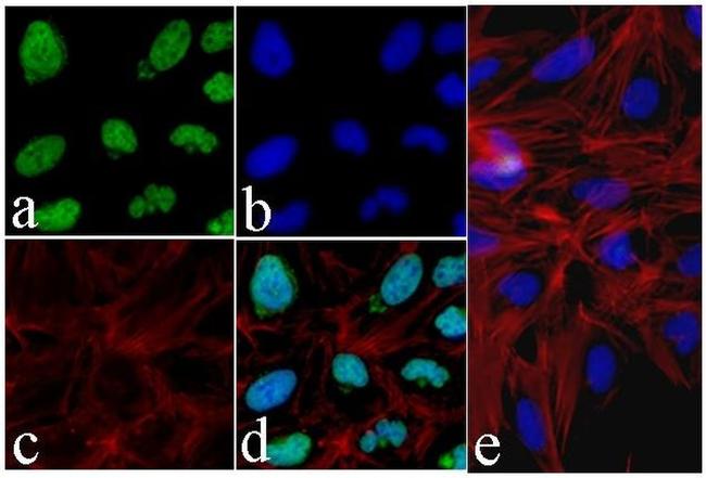 Phospho-Tau (Ser199) Antibody in Immunocytochemistry (ICC/IF)