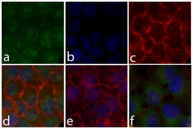 Phospho-STAT5 alpha (Tyr694) Antibody in Immunocytochemistry (ICC/IF)