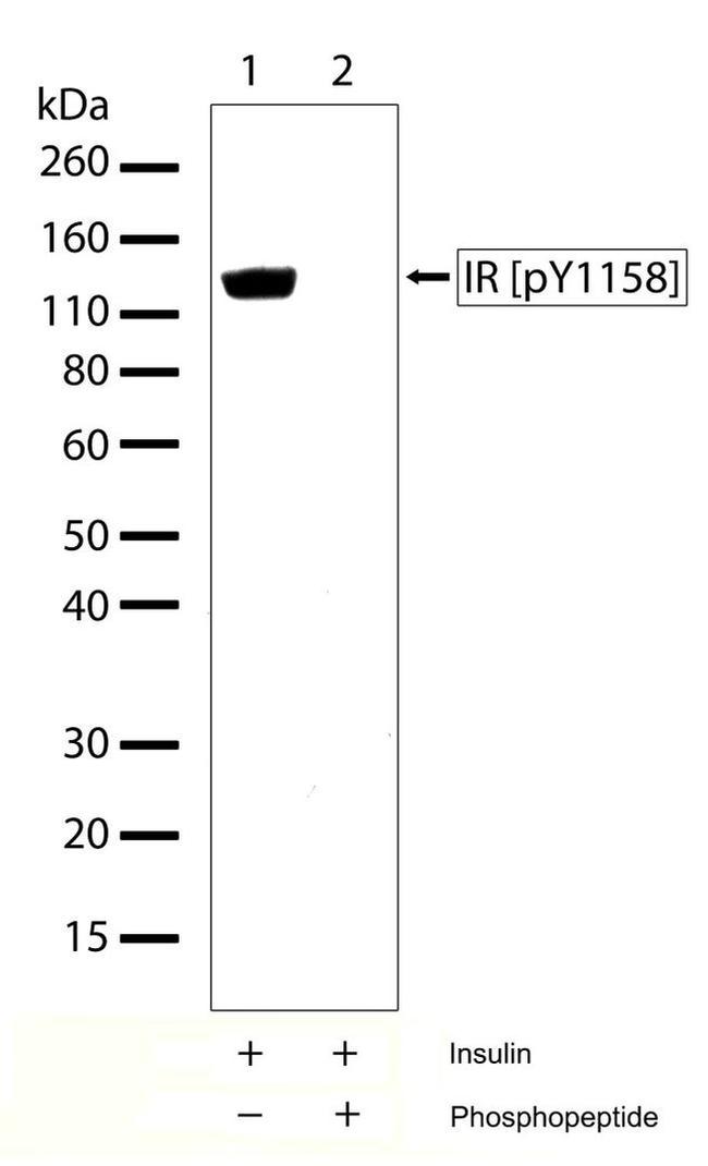 Phospho-INSR (Tyr1158) Antibody in Western Blot (WB)