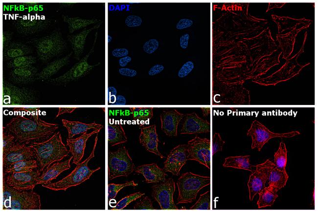 NFkB p65 Antibody in Immunocytochemistry (ICC/IF)