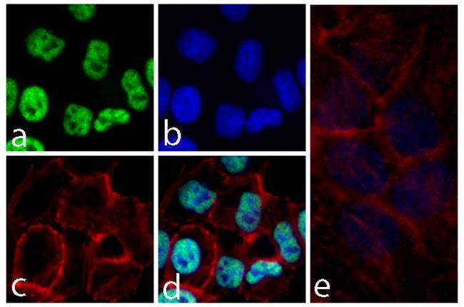 alpha Synuclein Antibody in Immunocytochemistry (ICC/IF)