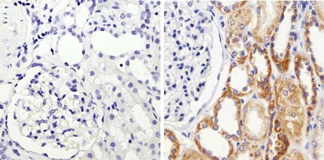 IkB alpha Antibody in Immunohistochemistry (Paraffin) (IHC (P))