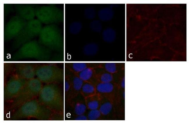 STAT5 beta Antibody in Immunocytochemistry (ICC/IF)