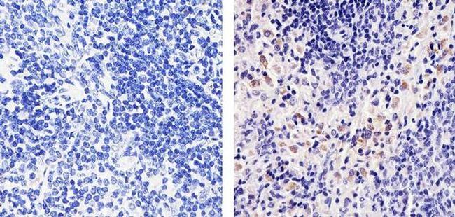 CXCL2 Antibody in Immunohistochemistry (Paraffin) (IHC (P))