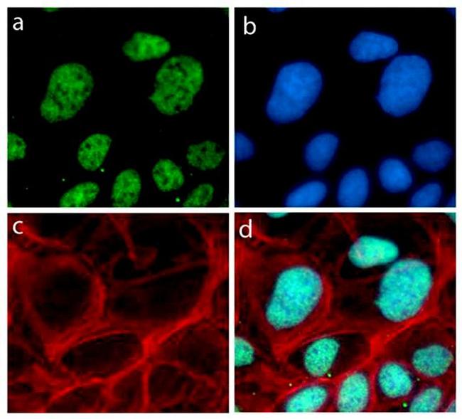 p21 Antibody in Immunocytochemistry (ICC/IF)