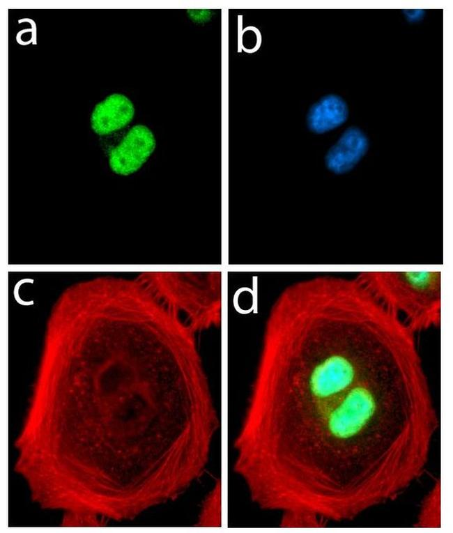 FABP4 Antibody in Immunocytochemistry (ICC/IF)