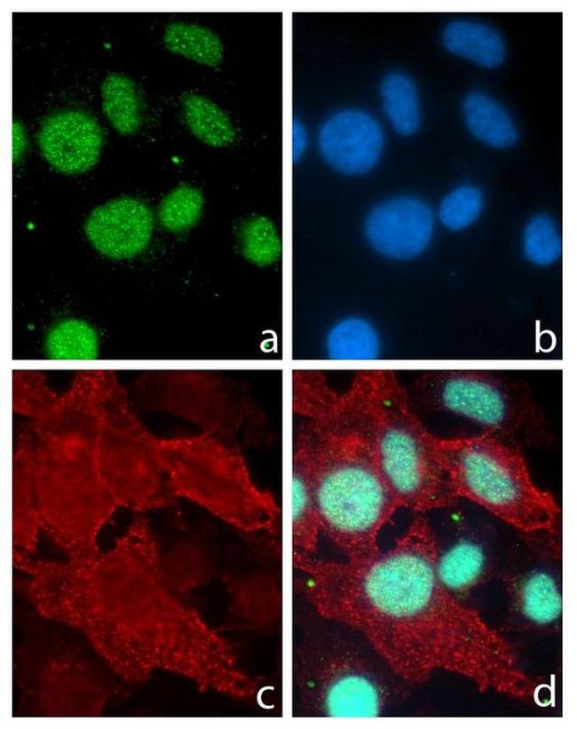 PITX3 Antibody in Immunocytochemistry (ICC/IF)