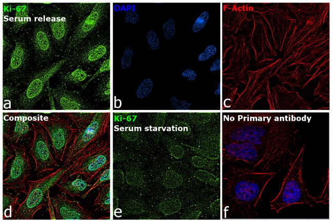 Ki-67 Antibody in Immunocytochemistry (ICC/IF)