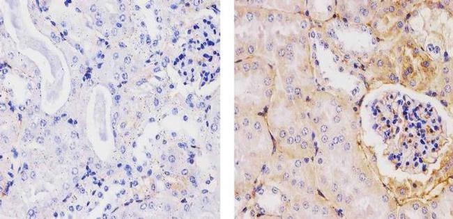 beta-2 Microglobulin Antibody in Immunohistochemistry (Paraffin) (IHC (P))