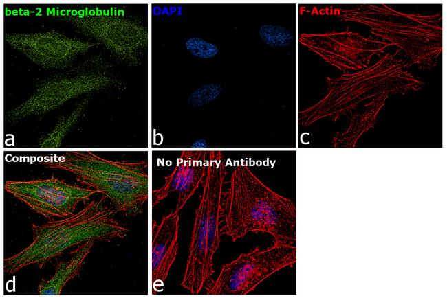 beta-2 Microglobulin Antibody in Immunocytochemistry (ICC/IF)