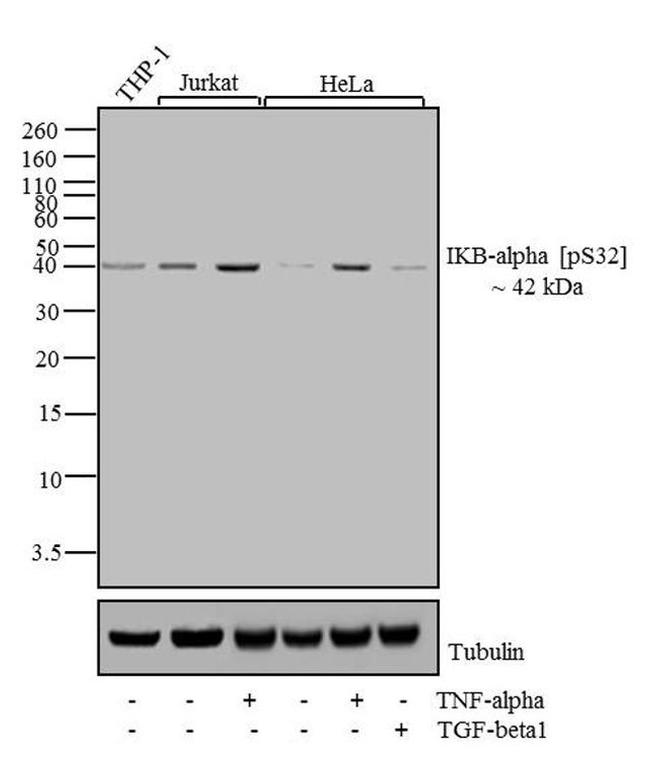 Phospho-IkB alpha (Ser32) Antibody in Western Blot (WB)