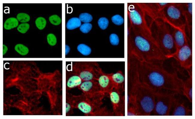 Phospho-Rb (Ser780) Antibody in Immunocytochemistry (ICC/IF)