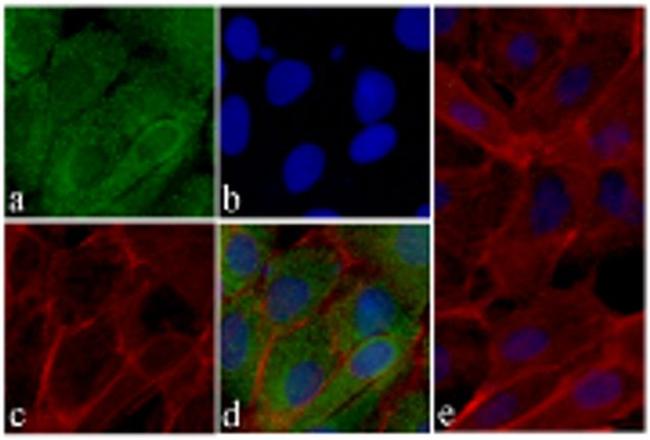 MMP3 Antibody in Immunocytochemistry (ICC/IF)