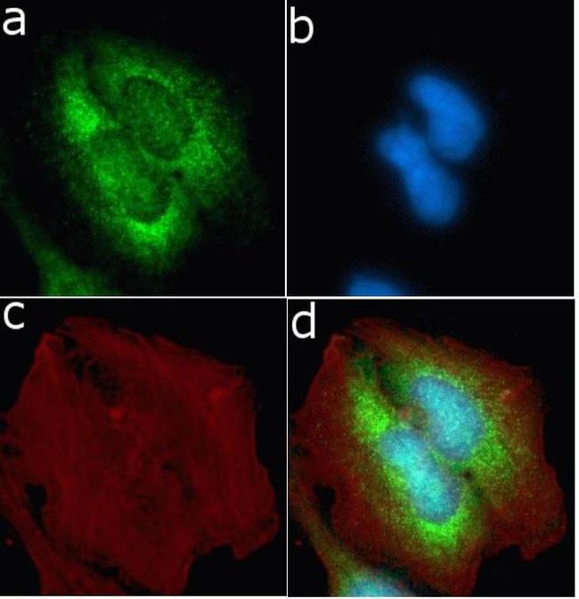 TIMP4 Antibody in Immunocytochemistry (ICC/IF)