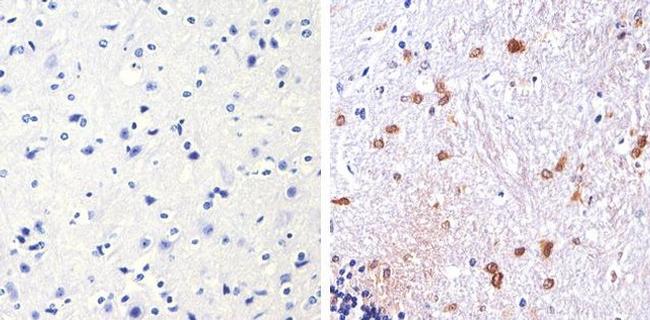 S100B Antibody in Immunohistochemistry (Paraffin) (IHC (P))