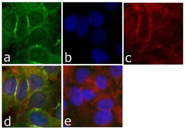 CD56 Antibody in Immunocytochemistry (ICC/IF)