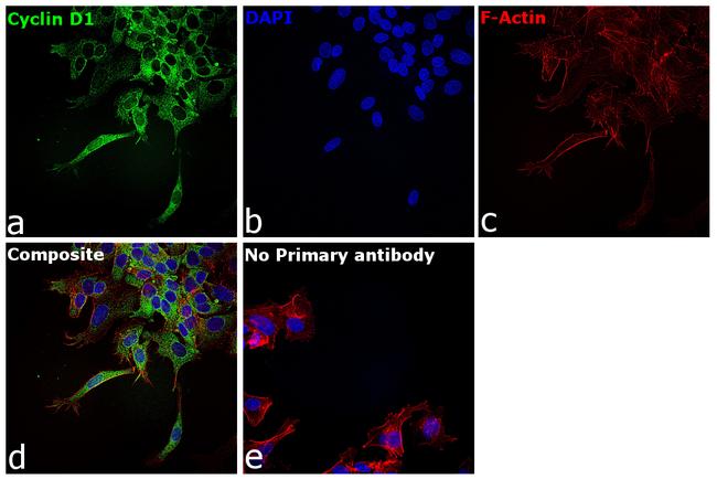 Cyclin D1 Antibody in Immunocytochemistry (ICC/IF)