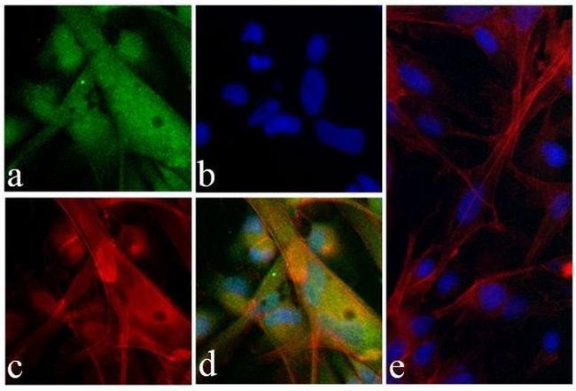 Alpha-Smooth Muscle Actin Antibody in Immunocytochemistry (ICC/IF)