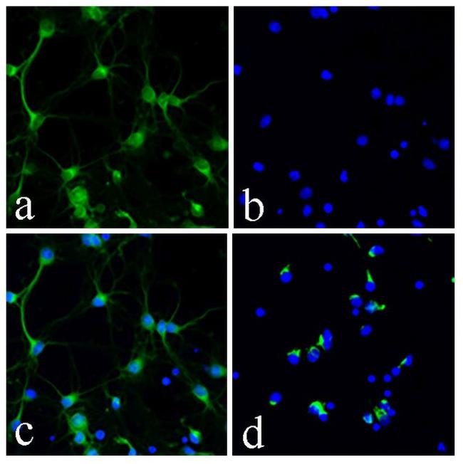 Synaptophysin Antibody in Immunocytochemistry (ICC/IF)