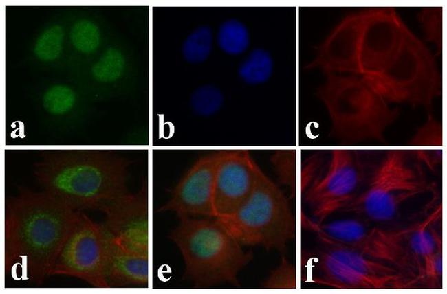 Phospho-SMAD2 (Ser465, Ser467) Antibody in Immunocytochemistry (ICC/IF)