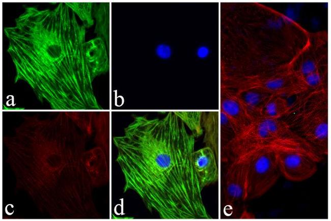 Troponin I Antibody in Immunocytochemistry (ICC/IF)