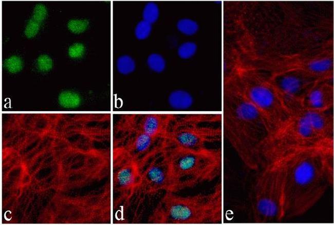 Nkx2.5 Antibody in Immunocytochemistry (ICC/IF)